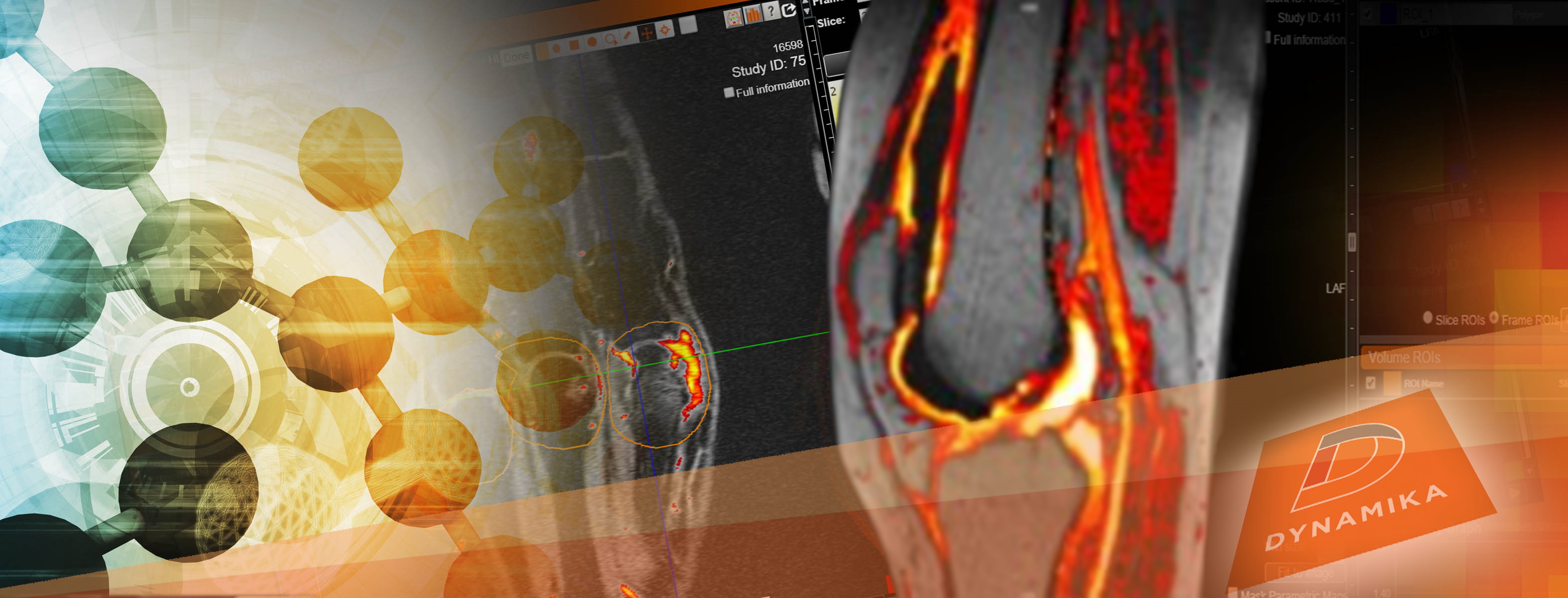 knee-OA-imaging