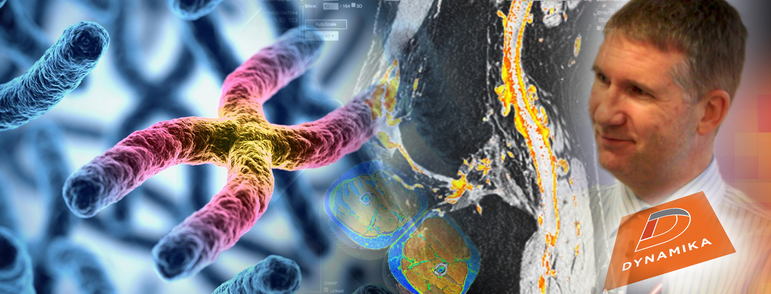 IAG-Cell-Gene-Therapy-Webinar-Advanced-Imaging