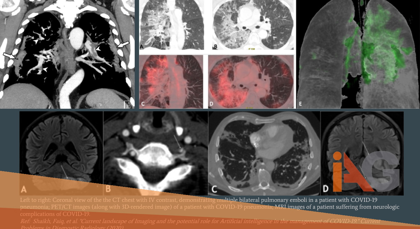 IAG-imaging-clinical-trials