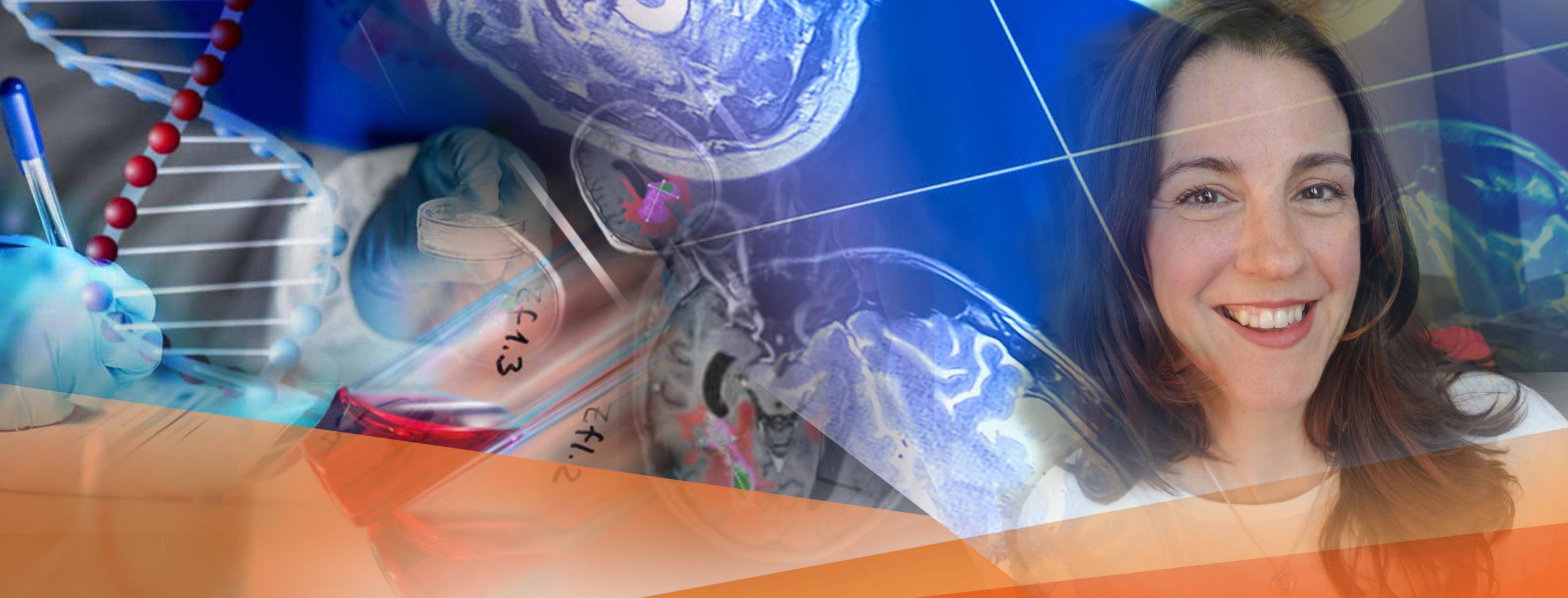 IAG-Neuro-Oncology