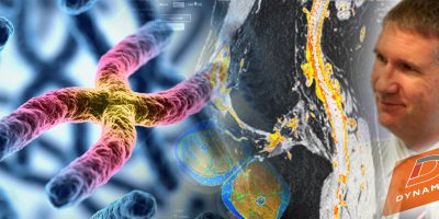 IAG-Cell-Gene-Therapy-Webinar-Advanced-Imaging