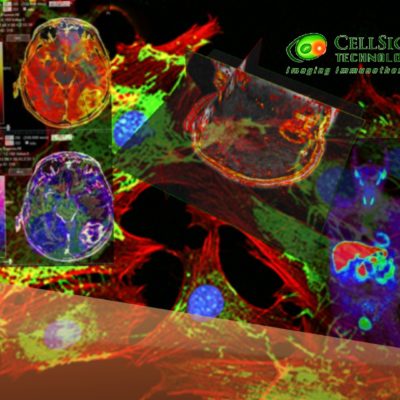 IAG-CellSight-Immunology-Oncology-Clinical-Trial